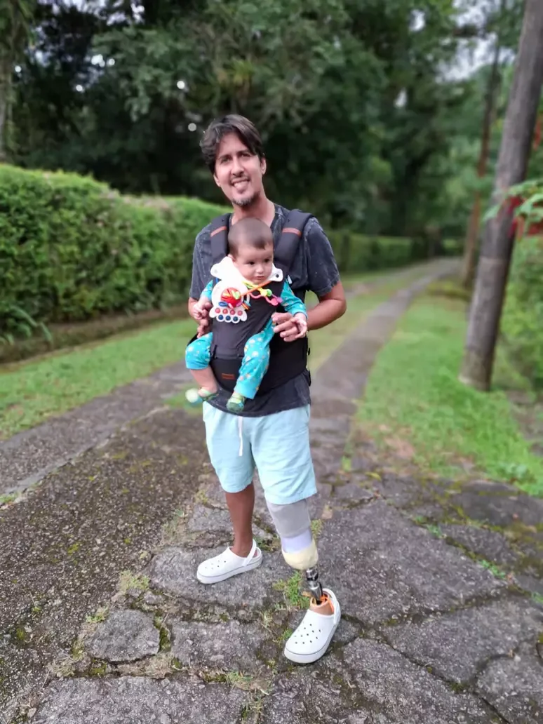 Júlio Cesar utiliza prótese que custou aproximadamente R$ 150 mil. Foto: Arquivo Pessoal | Terra