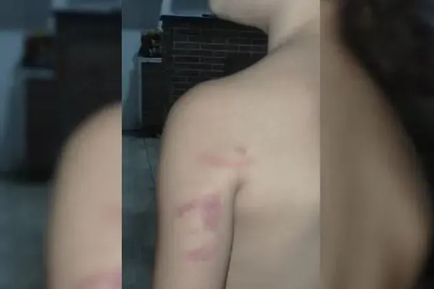 Professora agride e ajoelha na barriga de criança de 5 anos