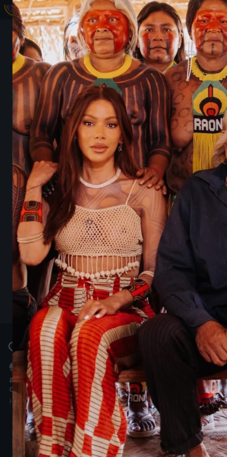 Anitta nunca escondeu ser adepta de cirurgias plásticas. | Foto: Redes Sociais