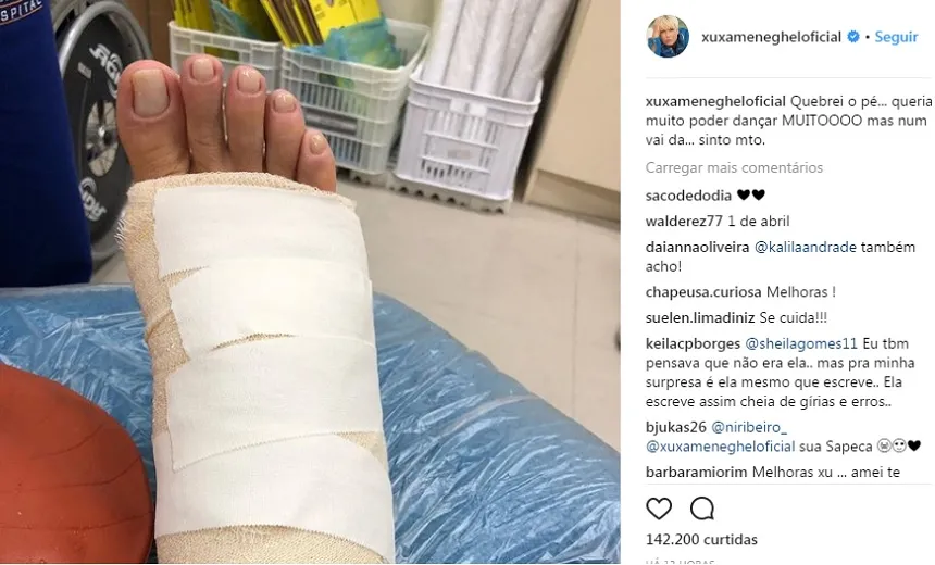 “Queria dançar muito, mas não vai dar”, lamenta Xuxa nas redes sociais depois de quebrar o pé