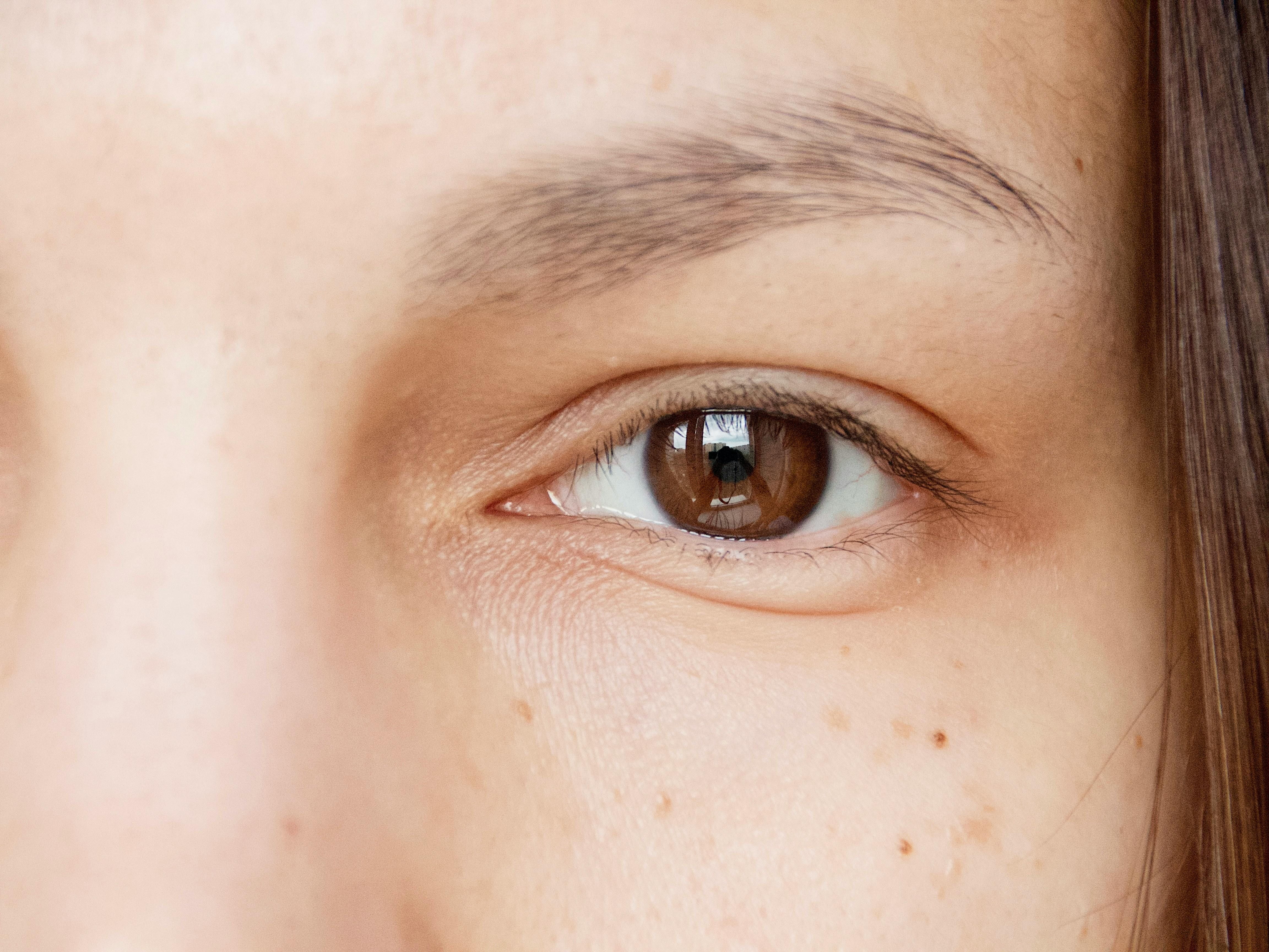 Olhos com mais níveis de melanina. | Foto: Ilustrativa/Pexels