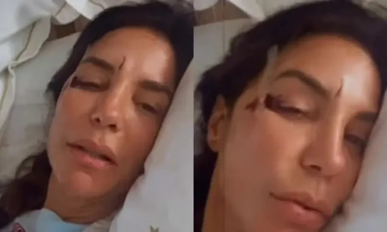 A cantora Ivete Sangalo passar&aacute; por uma cirurgia na manh&atilde; deste domingo (1&ordm;), em Salvador. | Foto: Redes Sociais