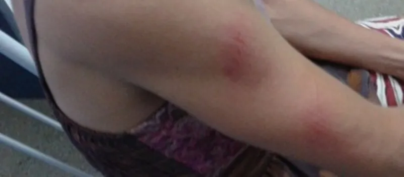 ‘PENSE AÍ’: Mãe denuncia filho de 14 anos que a agrediu com um pedaço de pau