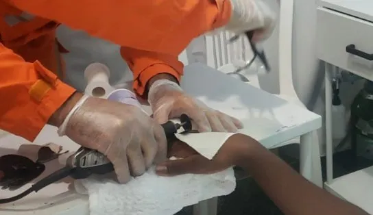 Em um mesmo dia, bombeiros são solicitados duas vezes para retirar anéis de dedos, em Luís Eduardo Magalhães