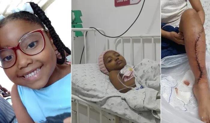 Maria Alice enfrenta câncer ósseo há um ano. A cirurgia para retirada do tumor foi bem sucedida, mas o tratamento ainda não terminou. Foto: Acervo pessoal