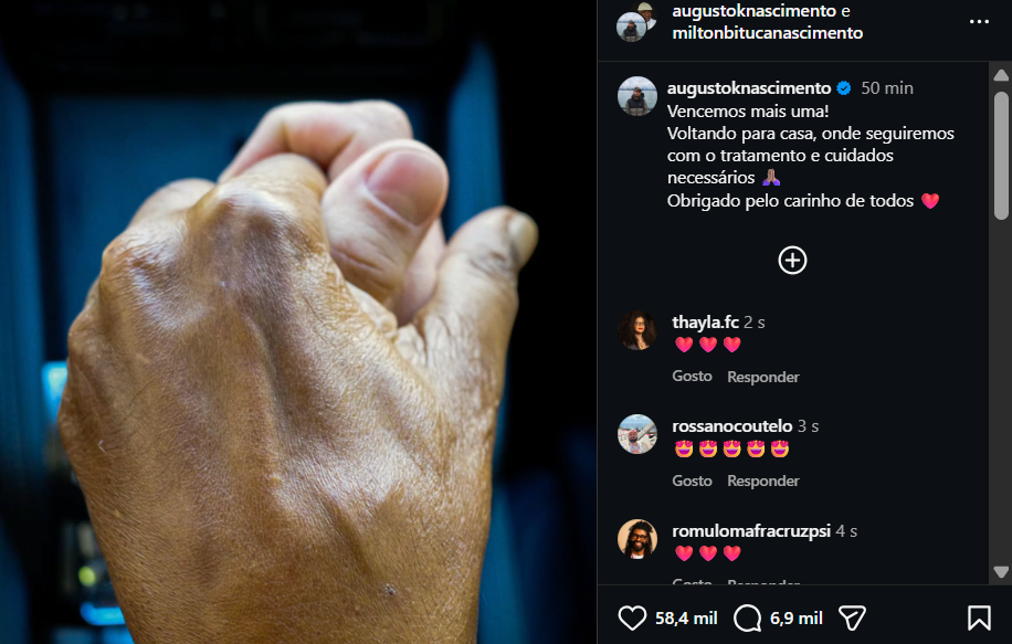 Milton Nascimento recebe alta hospitalar após internação por pneumonia.| Reprodução: Redes Sociais