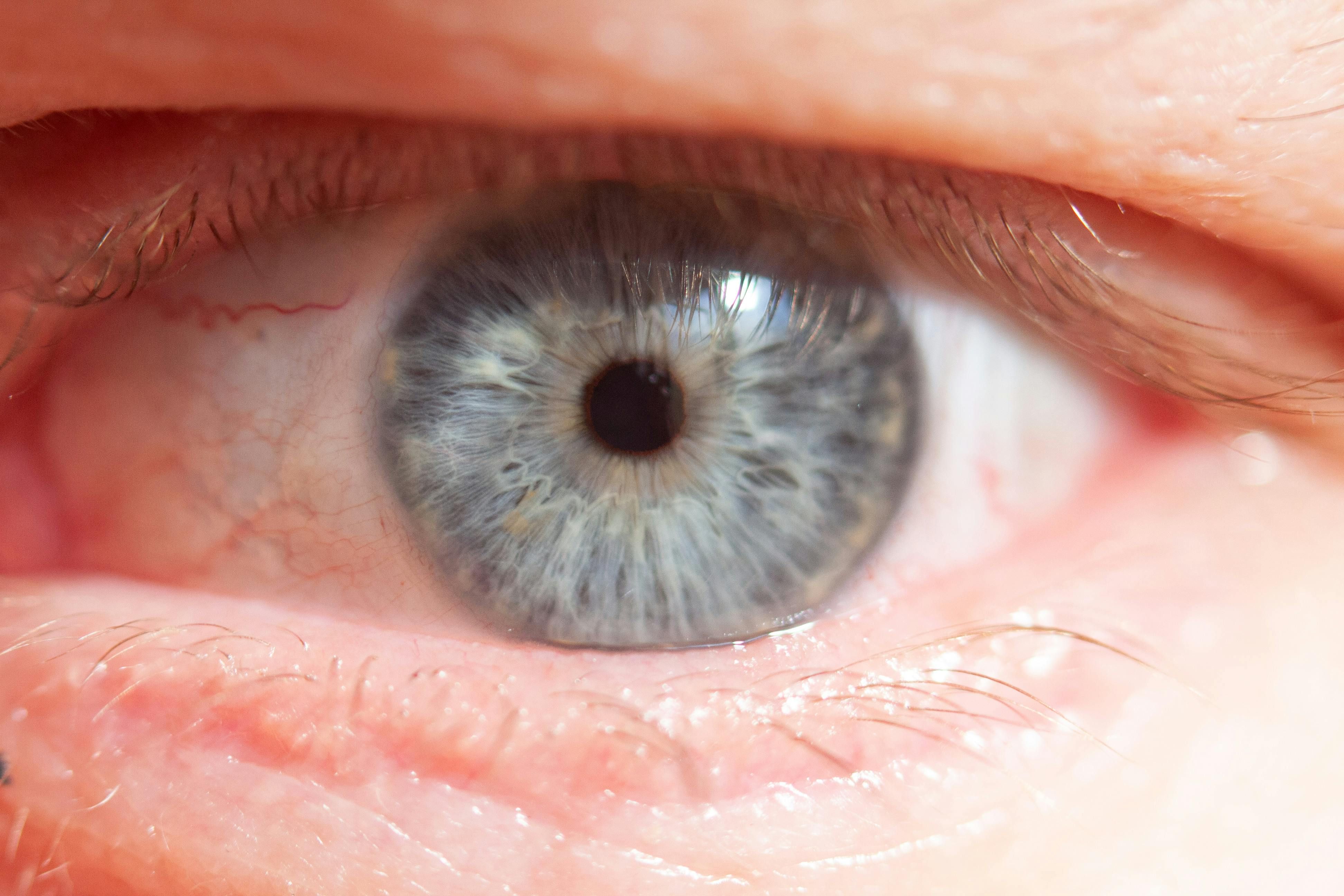 Considerada uma variação dos olhos azuis com estrutura da íris que dispersa a luz diferentemente. | Foto: Ilustrativa/Pexels