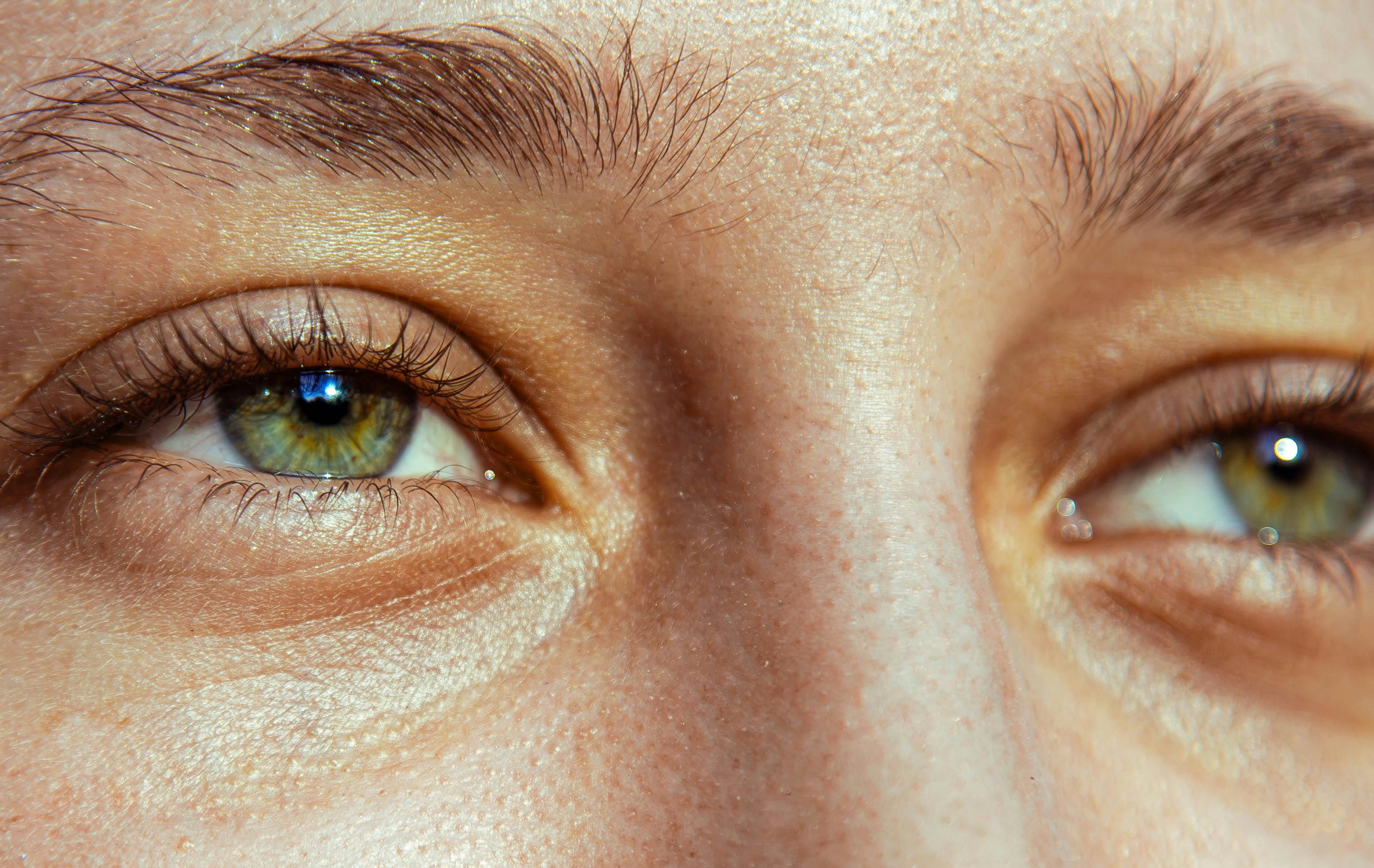 Uma das cores naturais mais raras. | Foto: Ilustrativa/Pexels