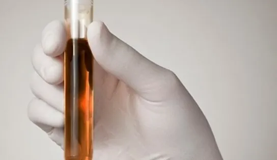 Três pessoas são diagnosticadas com a 'doença da urina preta' em Alagoinhas após consumirem peixe badejo