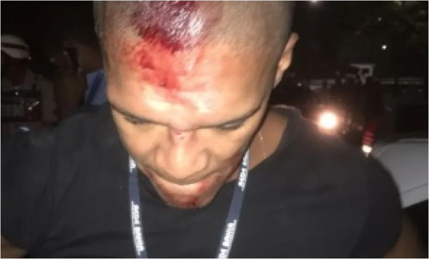 Repórter fotográfico é agredido por agentes da Transalvador na entrada do Barradão