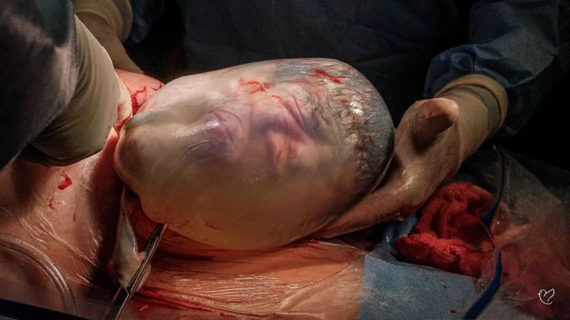 Bebê nasceu empelicado em Salvador, em 2023, e fotógrafa fez registro | Foto: Renata Casali