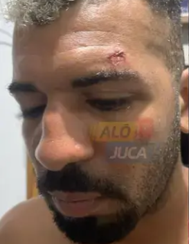 Homem Relata Ter Sido Agredido Pela Gcm