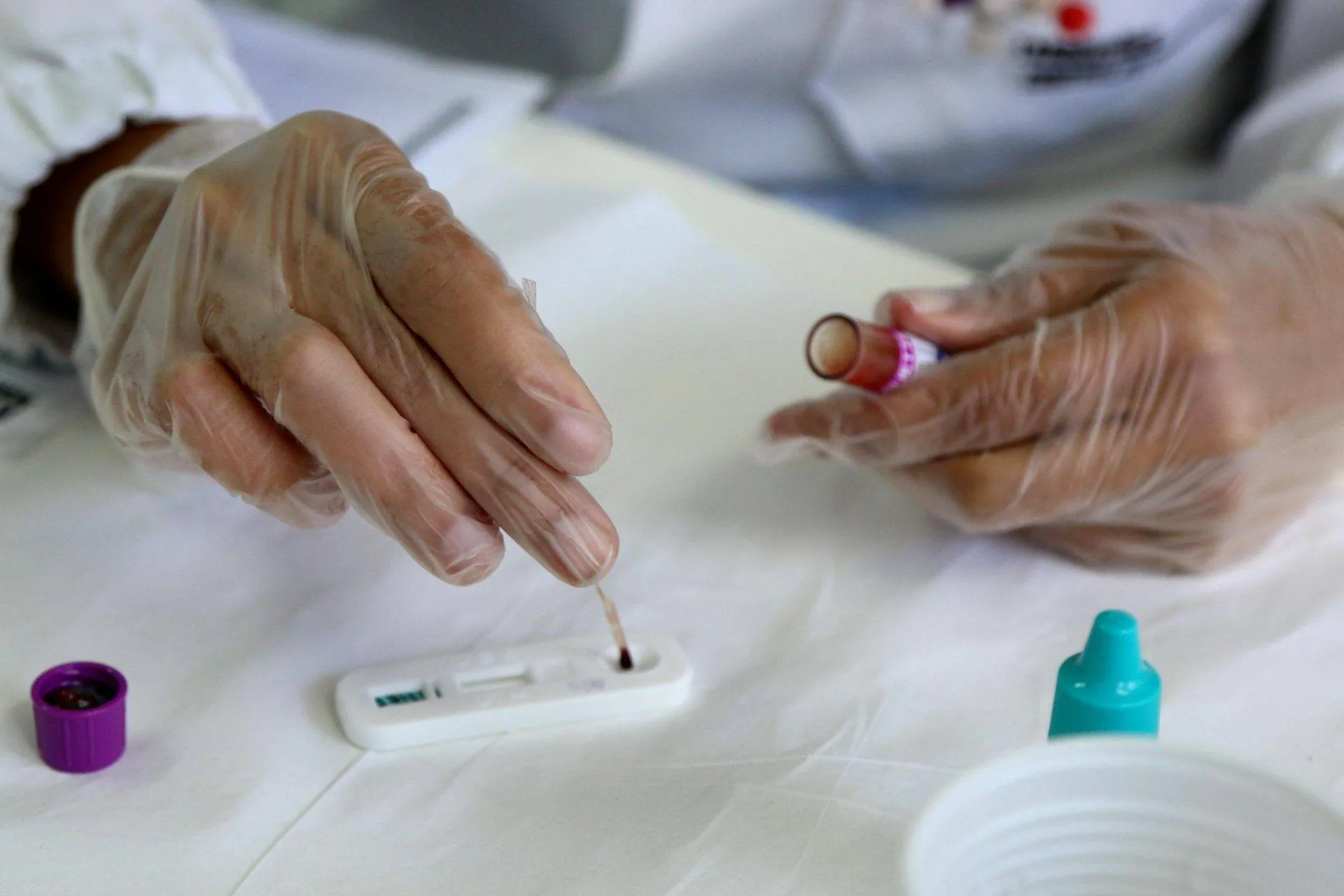 Diagnósticos gratuitos de HIV e outras doenças são oferecidos no Farol da Barra; saiba mais