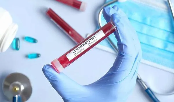 Quase 14 mil trabalhadores da indústria cederão amostras de saliva para testes de detecção do coronavírus 