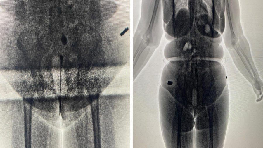 Mulheres são flagradas com drogas nas partes íntimas em presídio da Bahia.Foto: Divulgação | SSP-BA