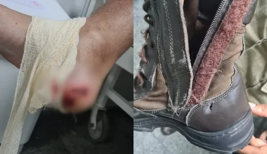 Suspeitos entram em confronto com a polícia, dão tiro no pé de PM e acabam baleados no Caminho de Areia