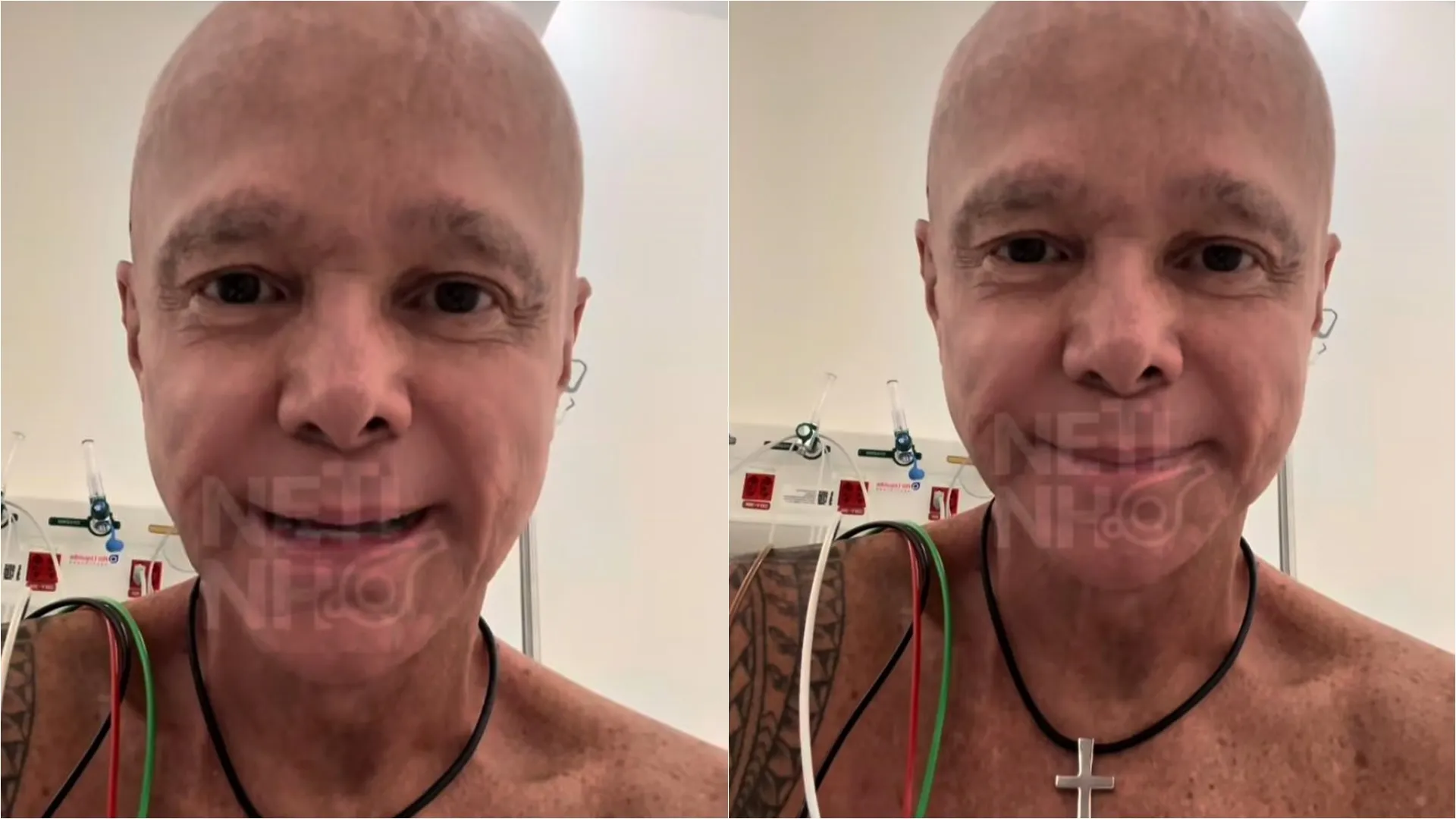 Netinho fala sobre tratamento contra o câncer: 'Tomei 128 injeções na barriga'