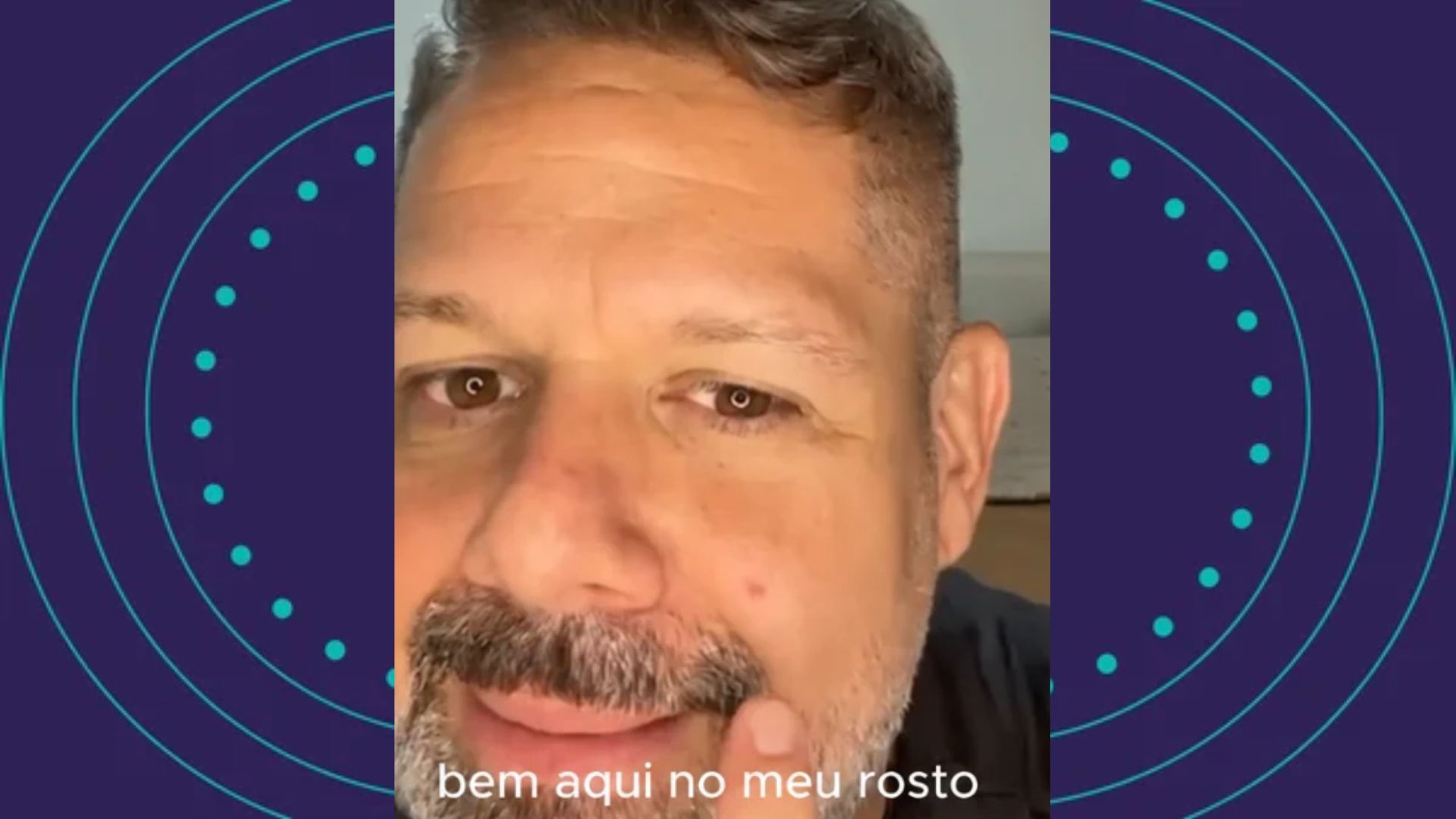 Danniel Vieira revela diagnostico de c&acirc;ncer de pele