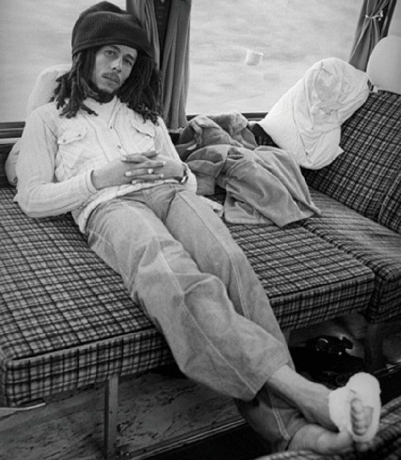 Bob Marley com o pé enfaixado, ferida que originou o câncer. Foto: Divulgação | bobmarley.com.br/fotos
