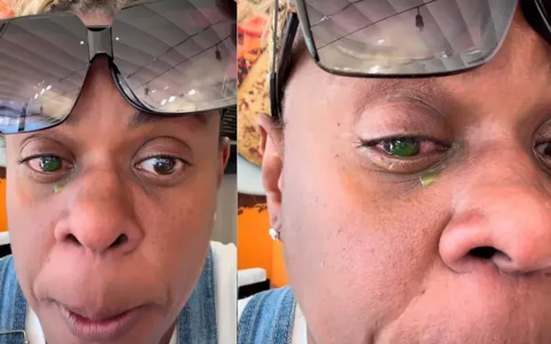 Especialistas alertam que subst&acirc;ncias qu&iacute;micas presentes em algumas pomadas modeladoras podem causar queimaduras na c&oacute;rnea e at&eacute; danos permanentes se entrarem em contato com os olhos/Foto: Redes Sociais&nbsp;