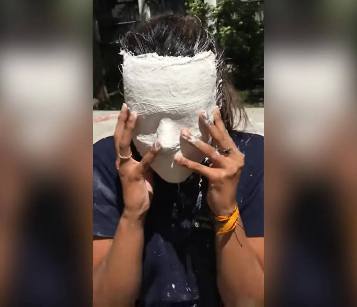Após jovem ficar com rosto preso em máscara, especialista alerta para cuidado com "produtos da internet"