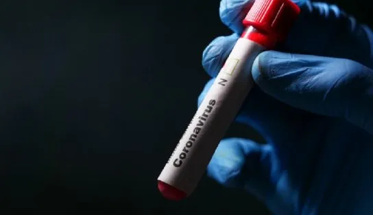 Brasil volta a ultrapassar 2 mil óbitos por Covid em 24 horas e registra 86 mil novos casos