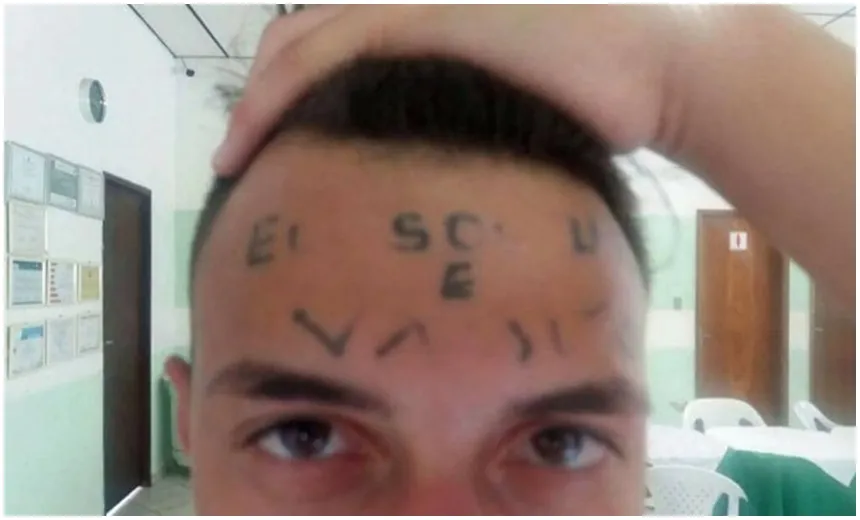 Jovem que teve testa tatuada deixa clínica após 16 meses internado; &#8220;ele não quer mais&#8221;