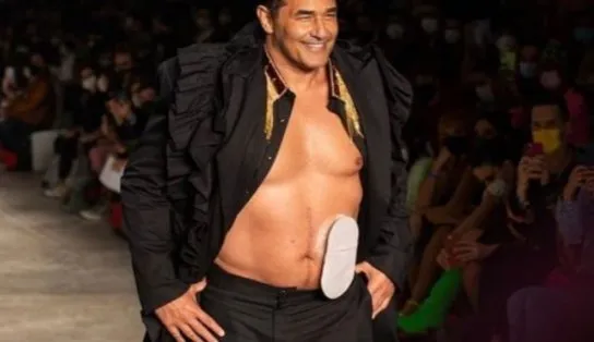 Luciano Szafir desfila na São Paulo Fashion Week com bolsa de estomia: "Não define ninguém"