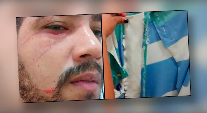 ESTRANHO, HEIN?: Motorista acusa Magary Lord de agressão; Cantor rebate: “ele quer se promover”