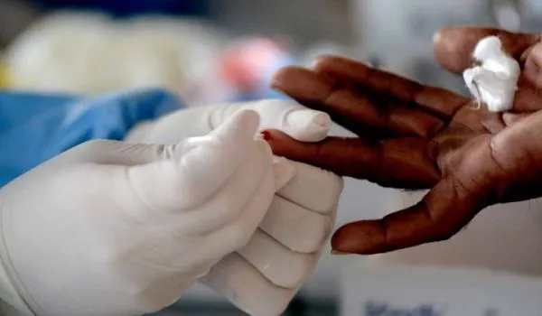 Em primeiro dia de medidas restritivas, testes detectam 170 pessoas com Covid-19 em Cajazeiras
