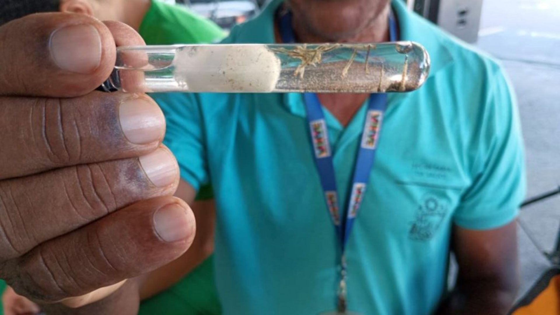 Casos de dengue na Bahia. Foto: Sa&uacute;de GovBA