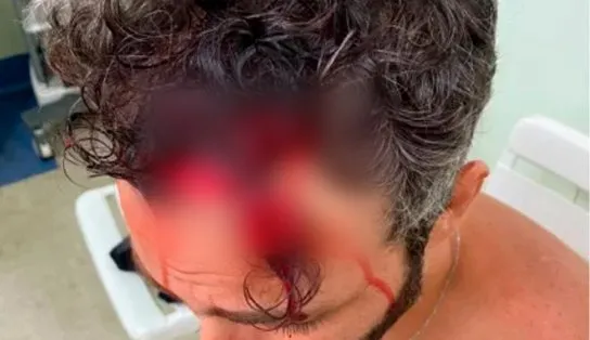  Ator global é espancado durante assalto e fica desacordado na rua