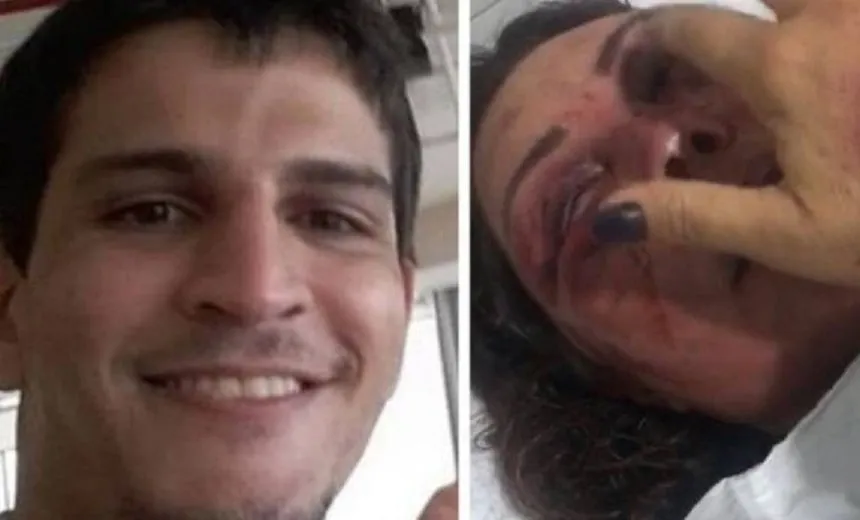 Homem que espancou paisagista agrediu irmão com deficiência física