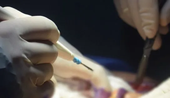 Miss russa diz que não consegue fechar os olhos após cirurgia de R$ 17 mil; veja resultado