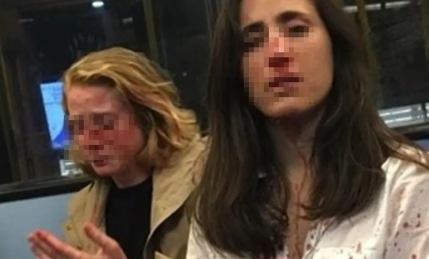 Polícia prende suspeitos de ataque homofóbico contra casal de mulheres