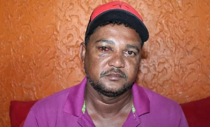 Ex-vereador e personal acusam PMs de agressão na Bahia; vídeo mostra ação