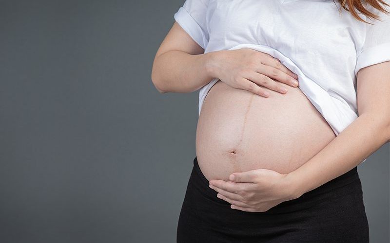 A laqueadura e a vasectomia n&atilde;o s&atilde;o 100% infal&iacute;veis. Em casos raros, pode ocorrer recanaliza&ccedil;&atilde;o dos canais reprodutivos, permitindo uma gravidez/Foto: Reprodu&ccedil;&atilde;o&nbsp;