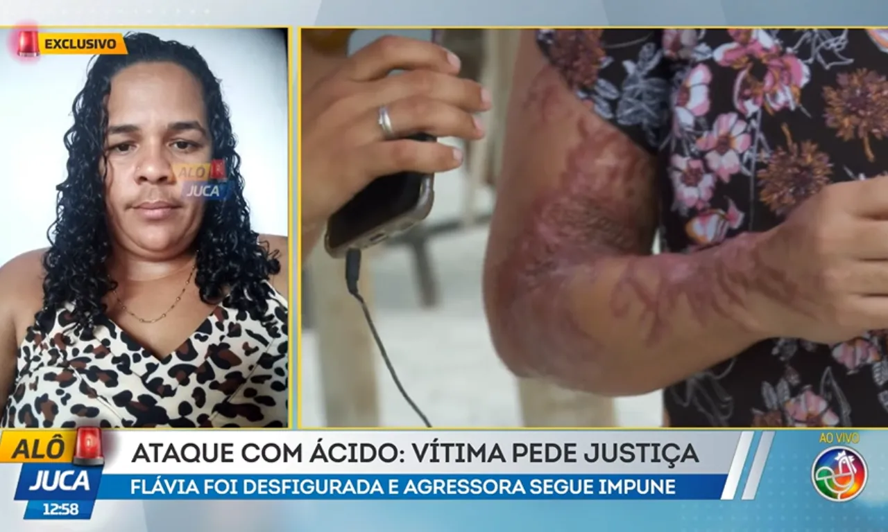 Ataque de ácido