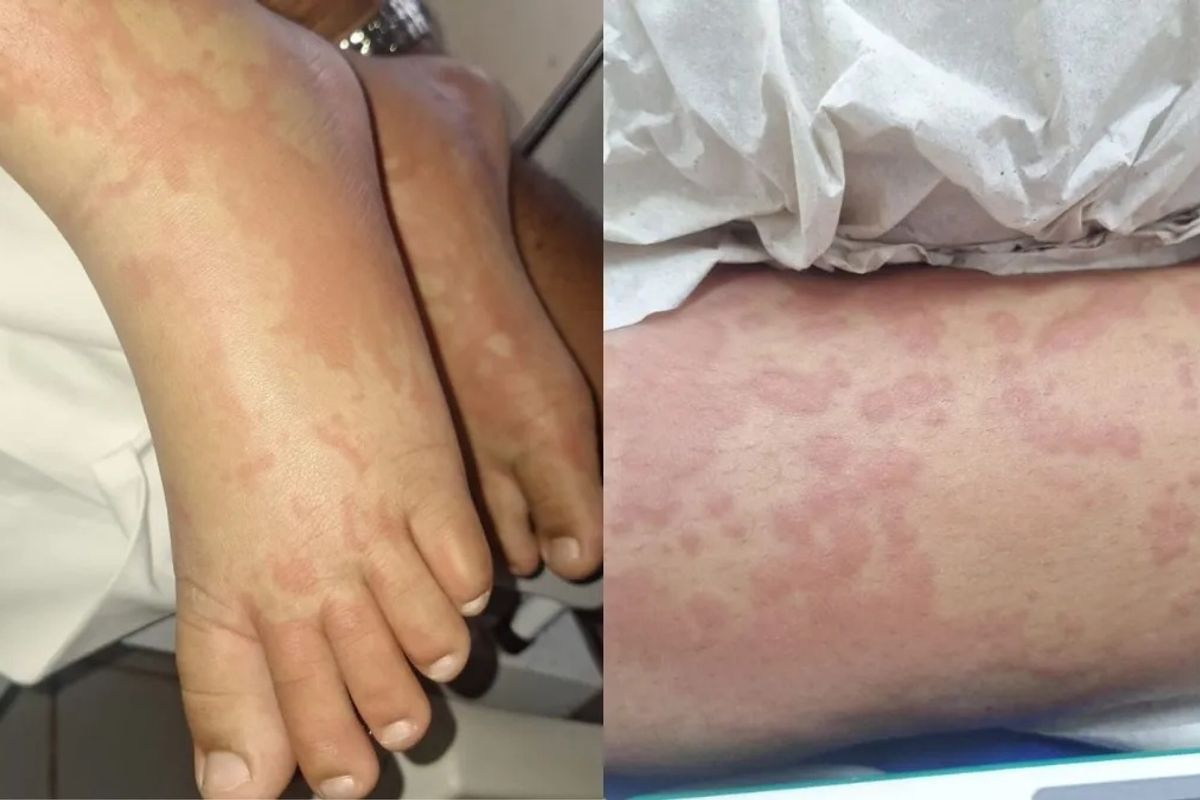 Criança é Internada após contato com produto Ypê. Foto: Arquivo Pessoal | Reproduçã/CNN