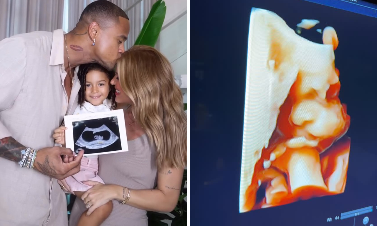 Leo Santana acompanha ultrassom com Lore Improta e reage: 'Minha cara'.Foto: Reprodu&ccedil;&atilde;o / redes sociais