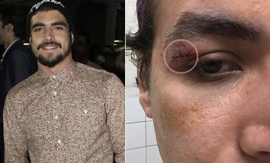 Justiça mantém condenação de Caio Castro por agressão a fotografo na Bahia