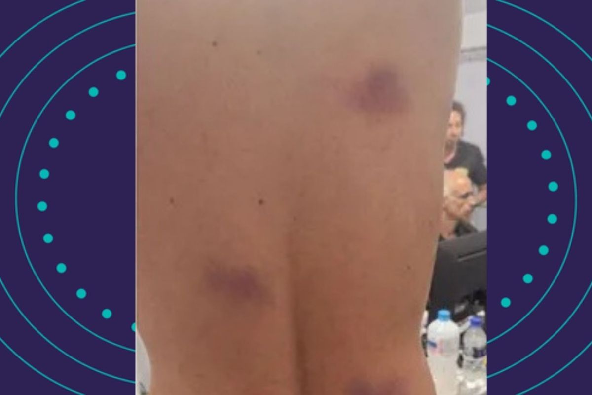 Sete PMs s&atilde;o acusados de provocar les&otilde;es corporais. Foto: Reprodu&ccedil;&atilde;o