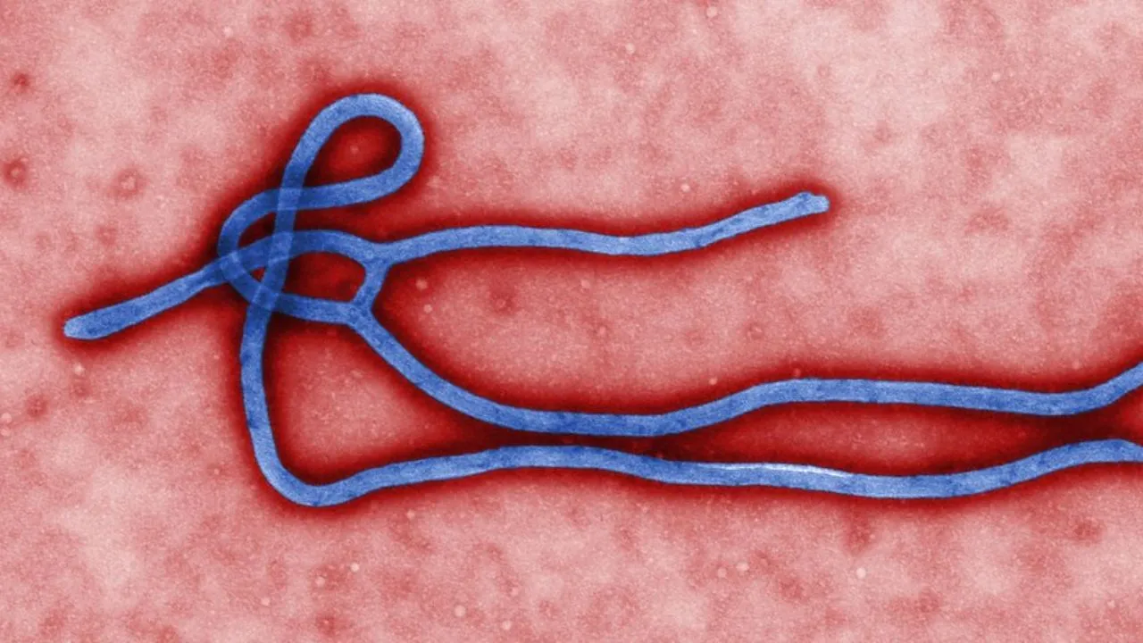 Ebola: o que se sabe sobre os dois casos suspeitos no Brasil