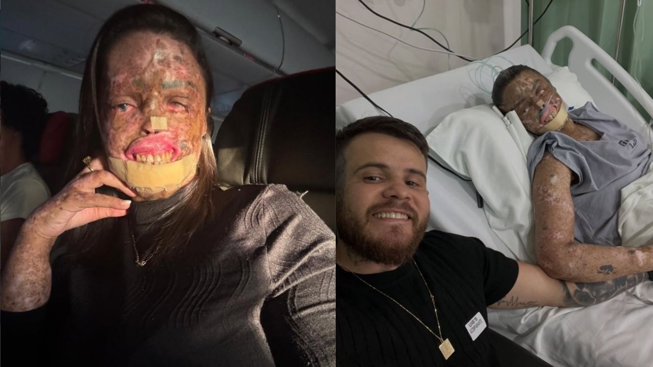 K&aacute;h Felipe Influencer Compartilhava Rotina De Tratamento Nas Redes Sociais Reprodu&ccedil;&atilde;o Instagram