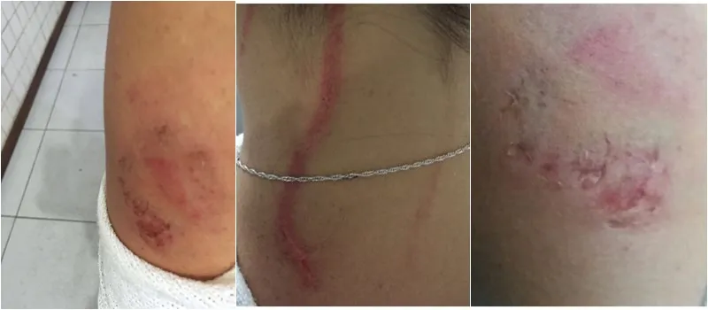 RESPOSTA: Sindicato dos Jornalistas emite nota repudiando agressão contra repórter da TV Aratu