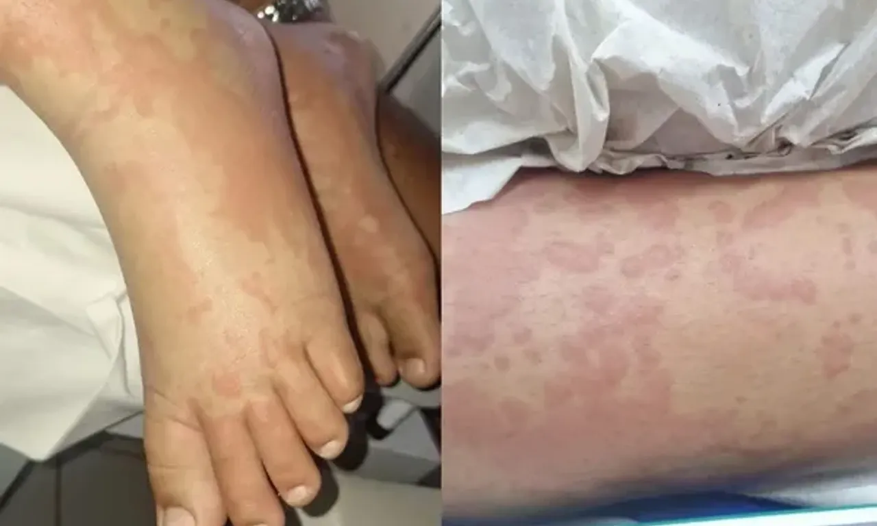 Uma crian&ccedil;a foi internada com suspeita de contamina&ccedil;&atilde;o ap&oacute;s uso de detergente da marca Yp&ecirc;. | Foto: Redes Sociais