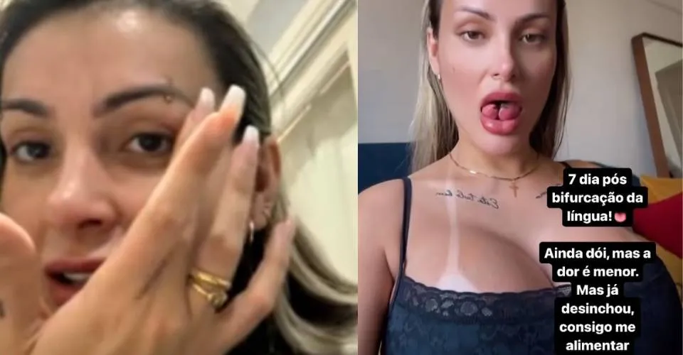 Além da lingua de cobra, Andressa Urach adere a moda do piercing genital: 'Ainda ta doído'