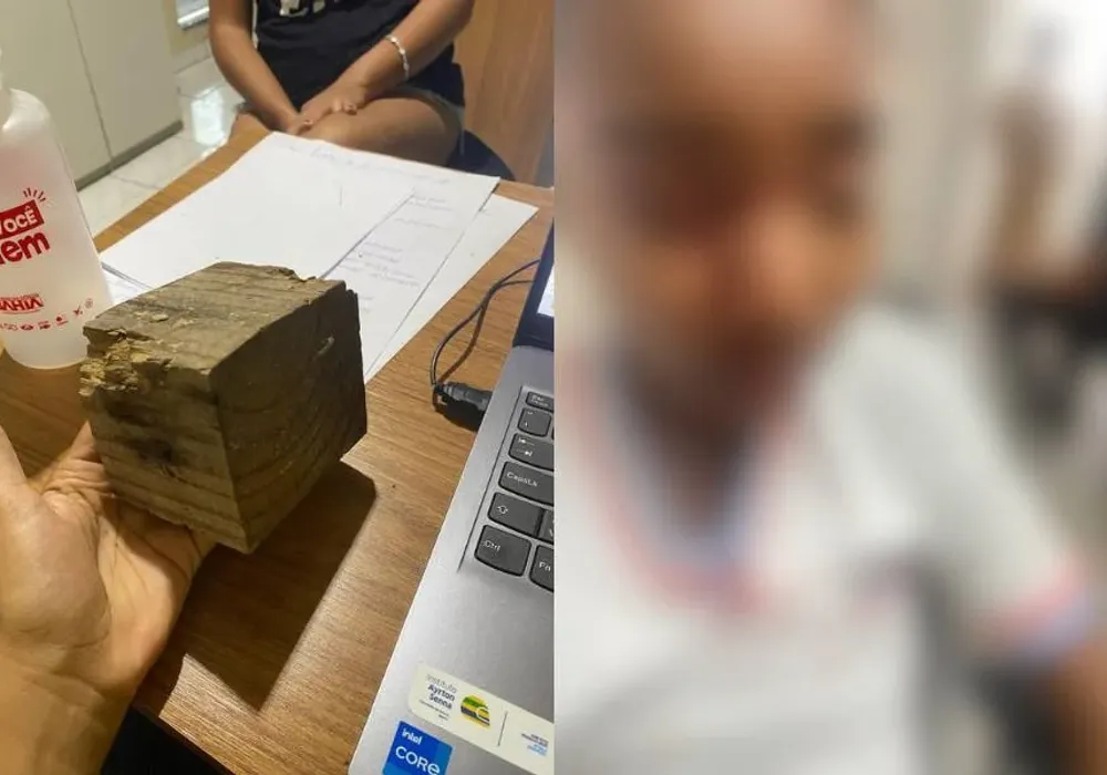 Jovem recebeu atendimento m&eacute;dico, mas les&atilde;o causou perda da vis&atilde;o | Reprodu&ccedil;&atilde;o/Redes Sociais