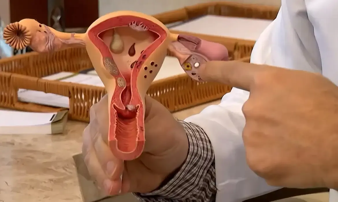 Papilomavírus humano (HPV) é a principal causa de câncer do colo do útero. Foto: TV Brasil