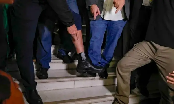 Bolsonaro mostrou a tornozeleira pela primeira vez, durante coletiva na Câmara dos Deputados. Foto: SBT News
